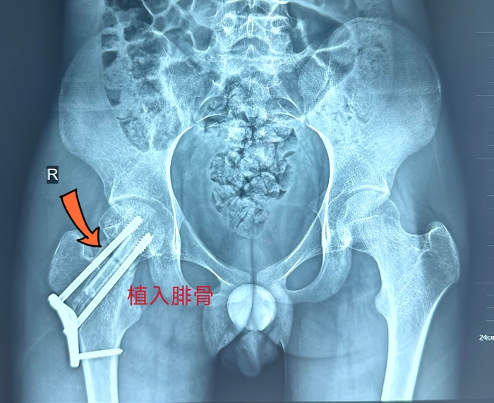 微信图片_20240327172105.jpg 微信图片_20240327172105.jpg